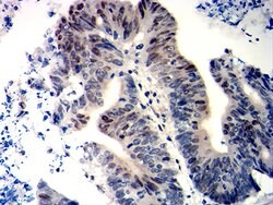 Invitrogen WT1 Monoclonal Antibody (7F9E8) 100 &mu;g; Unconjugated:Antibodies,