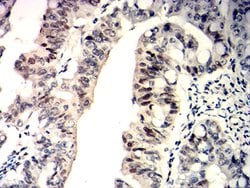 Invitrogen WT1 Monoclonal Antibody (7F9E8) 100 &mu;g; Unconjugated:Antibodies,