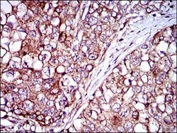 Invitrogen Rex1 Monoclonal Antibody (5E11A6) 100 &mu;g; Unconjugated:Antibodies,
