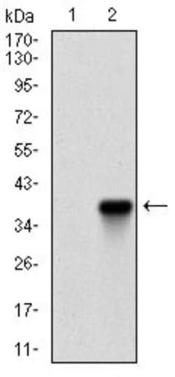Invitrogen Rex1 Monoclonal Antibody (5E11A6) 100 &mu;g; Unconjugated:Antibodies,