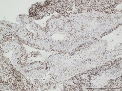 Invitrogen H3.3 G34W Recombinant Rabbit Monoclonal Antibody (RM263) 100