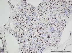 Invitrogen H3.3 G34W Recombinant Rabbit Monoclonal Antibody (RM263) 100