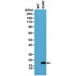 Invitrogen H3.3 G34V oncohistone mutant Recombinant Rabbit Monoclonal Antibody (RM307), ChIP-Verified 100 &mu;L | Buy Online | Invitrogen&trade; | Fisher Scientific