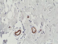 Invitrogen VEGF Recombinant Rabbit Monoclonal Antibody (RM391) 100 &mu;L;