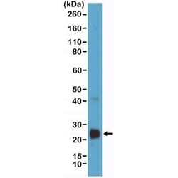 Invitrogen VEGF Recombinant Rabbit Monoclonal Antibody (RM391) 100 &mu;L;