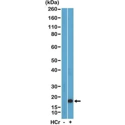 Invitrogen H3K27cr Recombinant Rabbit Monoclonal Antibody (RM401) 100 &mu;L;