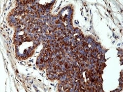 Invitrogen Annexin A1 Recombinant Rabbit Monoclonal Antibody (RM424) 100