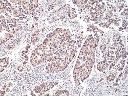 Invitrogen p70 S6 Kinase Recombinant Rabbit Monoclonal Antibody (RM438)