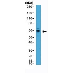 Invitrogen p70 S6 Kinase Recombinant Rabbit Monoclonal Antibody (RM438)