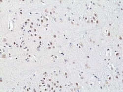 Invitrogen HDAC3 Recombinant Rabbit Monoclonal Antibody (RM439) 100 &mu;L;