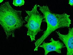 Invitrogen ADSL Recombinant Rabbit Monoclonal Antibody (007) 100 &mu;L;