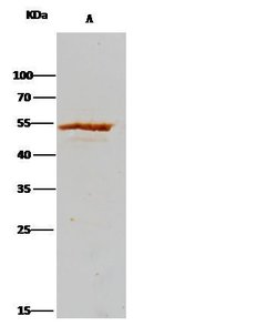 Invitrogen ADSL Recombinant Rabbit Monoclonal Antibody (007) 100 &mu;L;