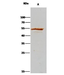 Invitrogen ADSL Recombinant Rabbit Monoclonal Antibody (007) 100 &mu;L;