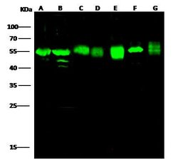 Invitrogen ADSL Recombinant Rabbit Monoclonal Antibody (007) 100 &mu;L;