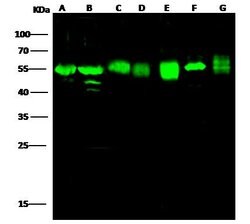 Invitrogen ADSL Recombinant Rabbit Monoclonal Antibody (007) 100 &mu;L;