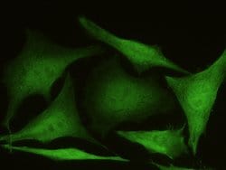 Invitrogen AKR1B1 Recombinant Rabbit Monoclonal Antibody (109) 100 &mu;L;