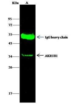 Invitrogen AKR1B1 Recombinant Rabbit Monoclonal Antibody (109) 100 &mu;L;