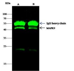 Invitrogen JNK2 Recombinant Rabbit Monoclonal Antibody (004) 100 &mu;L;