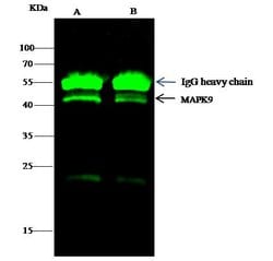 Invitrogen JNK2 Recombinant Rabbit Monoclonal Antibody (004) 100 &mu;L;