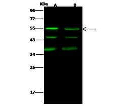 Invitrogen JNK2 Recombinant Rabbit Monoclonal Antibody (004) 100 &mu;L;