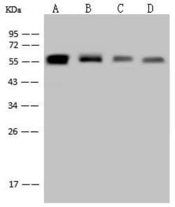 Invitrogen Vimentin Recombinant Rabbit Monoclonal Antibody (001) 100 &mu;L | Buy Online | Invitrogen&trade; | Fisher Scientific