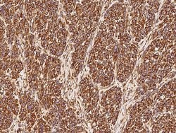 Invitrogen Vimentin Recombinant Rabbit Monoclonal Antibody (001) 100 &mu;L | Buy Online | Invitrogen&trade; | Fisher Scientific
