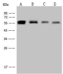Invitrogen Vimentin Recombinant Rabbit Monoclonal Antibody (001) 100 &mu;L | Buy Online | Invitrogen&trade; | Fisher Scientific