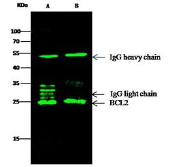 Invitrogen Bcl-2 Monoclonal Antibody (09) 100 &mu;L; Unconjugated:Antibodies,