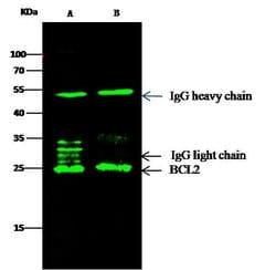 Invitrogen Bcl-2 Monoclonal Antibody (09) 100 &mu;L; Unconjugated:Antibodies,