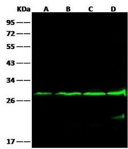 Invitrogen Bcl-2 Monoclonal Antibody (09) 100 &mu;L; Unconjugated:Antibodies,