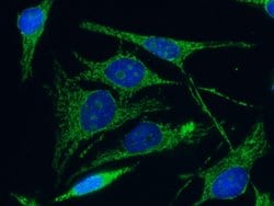 Invitrogen C1QBP Monoclonal Antibody (04) 100 &mu;L; Unconjugated:Antibodies,