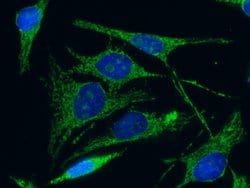 Invitrogen C1QBP Monoclonal Antibody (04) 100 &mu;L; Unconjugated:Antibodies,