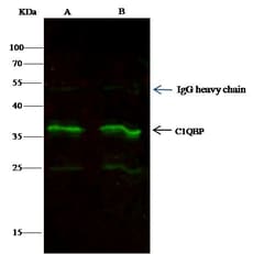 Invitrogen C1QBP Monoclonal Antibody (04) 100 &mu;L; Unconjugated:Antibodies,