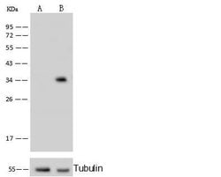 Invitrogen C1QBP Monoclonal Antibody (04) 100 &mu;L; Unconjugated:Antibodies,