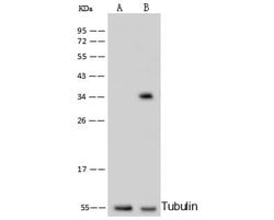 Invitrogen C1QBP Monoclonal Antibody (04) 100 &mu;L; Unconjugated:Antibodies,