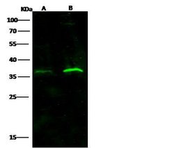 Invitrogen IFNAR2 Monoclonal Antibody (03) 100 &mu;L; Unconjugated:Antibodies,