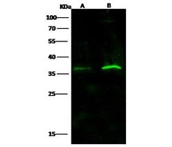 Invitrogen IFNAR2 Monoclonal Antibody (03) 100 &mu;L; Unconjugated:Antibodies,
