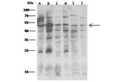 Invitrogen JNK2 Monoclonal Antibody (3C3C12E5) 100 &mu;L | Buy Online | Invitrogen&trade; | Fisher Scientific
