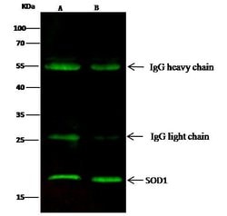 Invitrogen SOD1 Monoclonal Antibody (11) 100 &mu;L; Unconjugated:Antibodies,