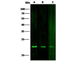 Invitrogen SOD1 Monoclonal Antibody (11) 100 &mu;L; Unconjugated:Antibodies,