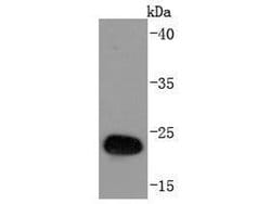 Invitrogen GST Recombinant Rabbit Monoclonal Antibody (JM57-10), HRP 100