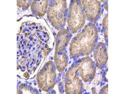 Invitrogen IDH1 Monoclonal Antibody (A11-B4) 100 &mu;L | Buy Online | Invitrogen&trade; | Fisher Scientific