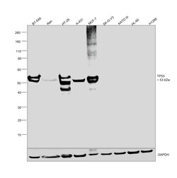 Invitrogen p53 Recombinant Rabbit Monoclonal Antibody (SA39-07) 100 &mu;L;