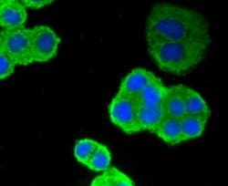 Invitrogen p53 Recombinant Rabbit Monoclonal Antibody (SA39-07) 100 &mu;L;