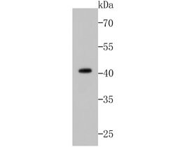 Invitrogen p53 Recombinant Rabbit Monoclonal Antibody (SA39-07) 100 &mu;L;