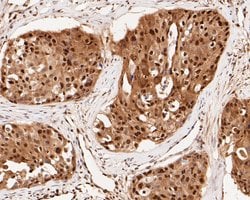 Invitrogen CREB Recombinant Rabbit Monoclonal Antibody (SA04-04) 100 &mu;L;