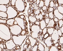 Invitrogen CREB Recombinant Rabbit Monoclonal Antibody (SA04-04) 100 &mu;L;