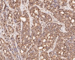 Invitrogen CREB Recombinant Rabbit Monoclonal Antibody (SA04-04) 100 &mu;L;