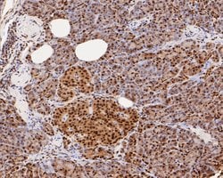 Invitrogen CREB Recombinant Rabbit Monoclonal Antibody (SA04-04) 100 &mu;L;