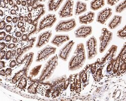 Invitrogen CREB Recombinant Rabbit Monoclonal Antibody (SA04-04) 100 &mu;L;